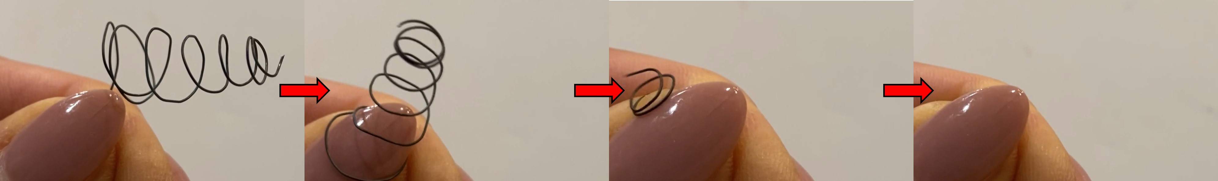 The AngioShield filter being retrieved